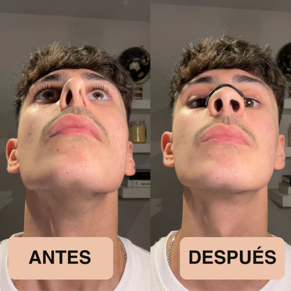 CalmAir™ - Dilatador nasal magnetico
